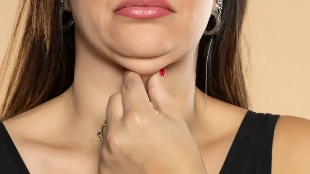 An image of a woman with double chin, sad, worried : Non Surgical Double Chin Removal Treatment in Westbury, UK