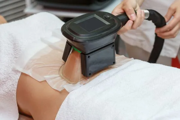 Image of person having fat freezing treatment to help weight gain Westbury