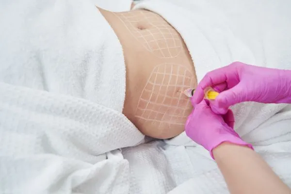 image of fat dissolving injections on love handles to help combat weight gain Westbury
