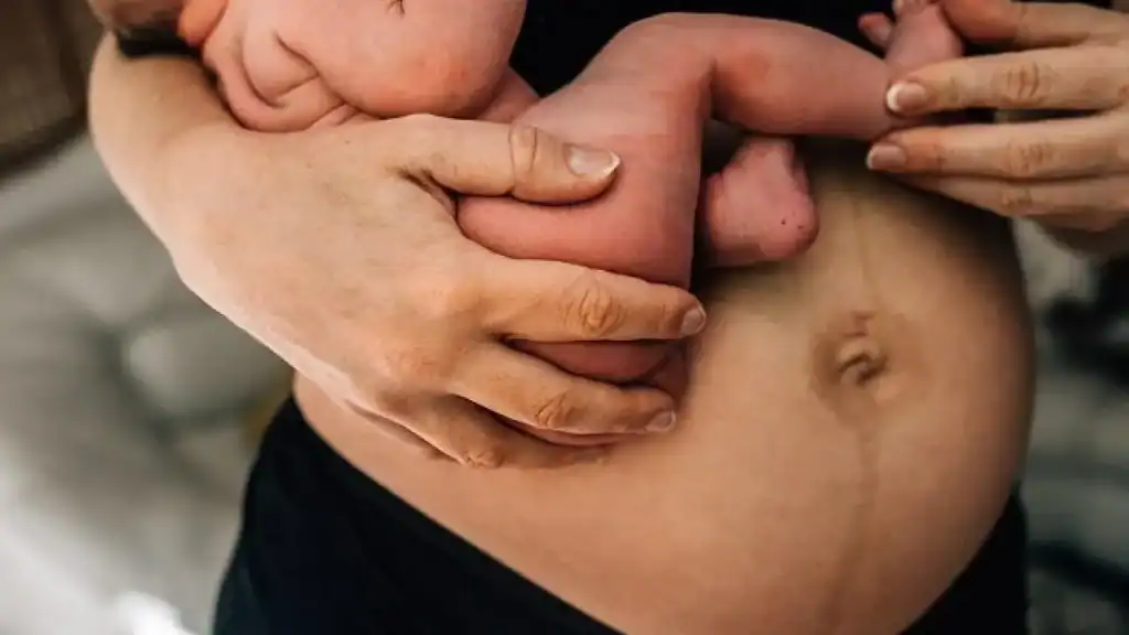 Why Is My Stomach Still Big After Pregnancy Westbury?